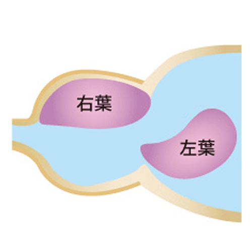 ホルミウムレーザーの特性-2