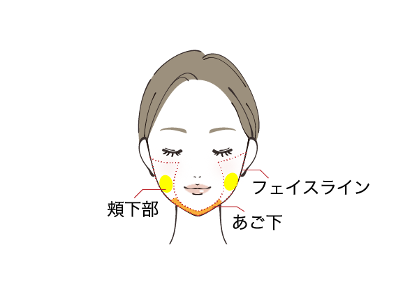 頬下部、フェイスライン、あご下