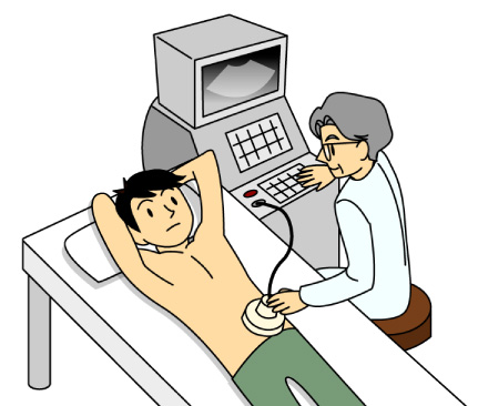 超音波（エコー）検査