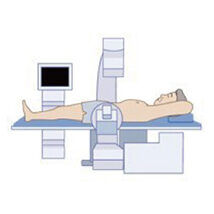 体外衝撃波尿路結石砕石術（ESWL）